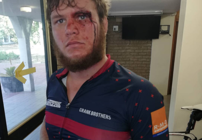 Two cyclists violently attacked in Stellenbosch