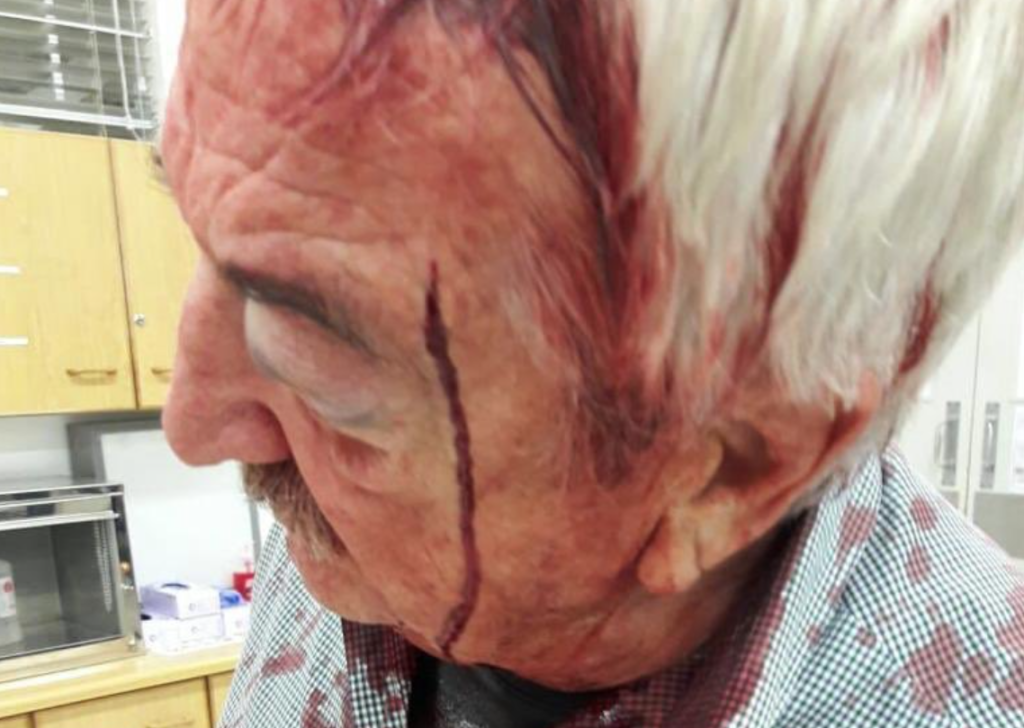 Elderly man hurt in Citrusdal Farm attack