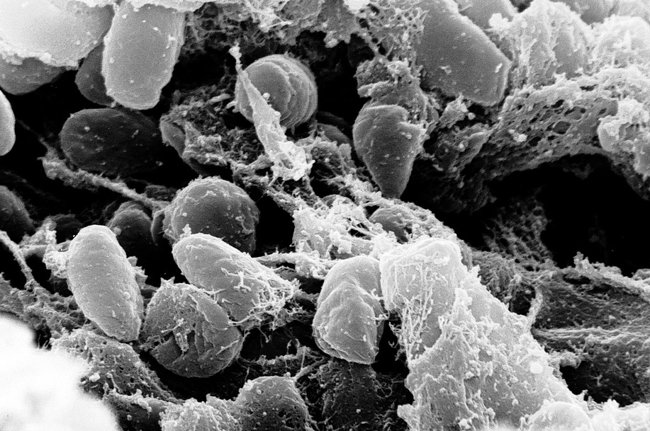 Suspected bubonic plague case in China