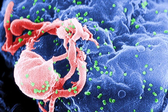 Wits researchers announce “breakthrough” in HIV prevention