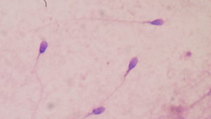 New study suggests COVID-19 reduces male fertility, experts are unconvinced