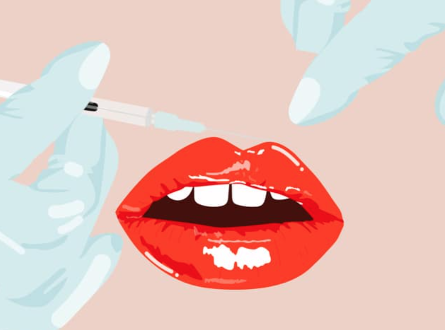 Should people in their 20s get Botox and or lip fillers? The spectrum of thoughts