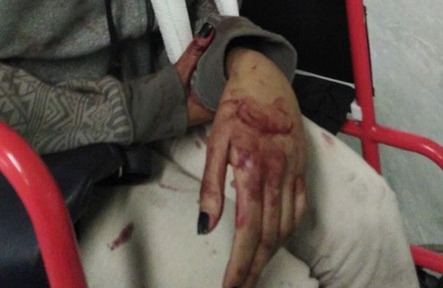 Cape Town woman brutally assaulted after coming to the rescue of an elderly man