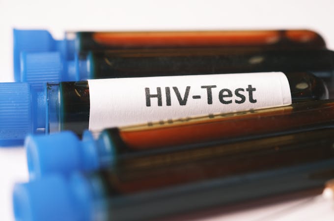 UCT and PHRI leads new clinical trial to reduce HIV-related deaths